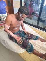 নওগাঁয় মাদক মামলায় সাক্ষী হওয়ায় যুবককে পেট্রোল ঢেলে পুড়িয়ে হত্যার চেষ্টা